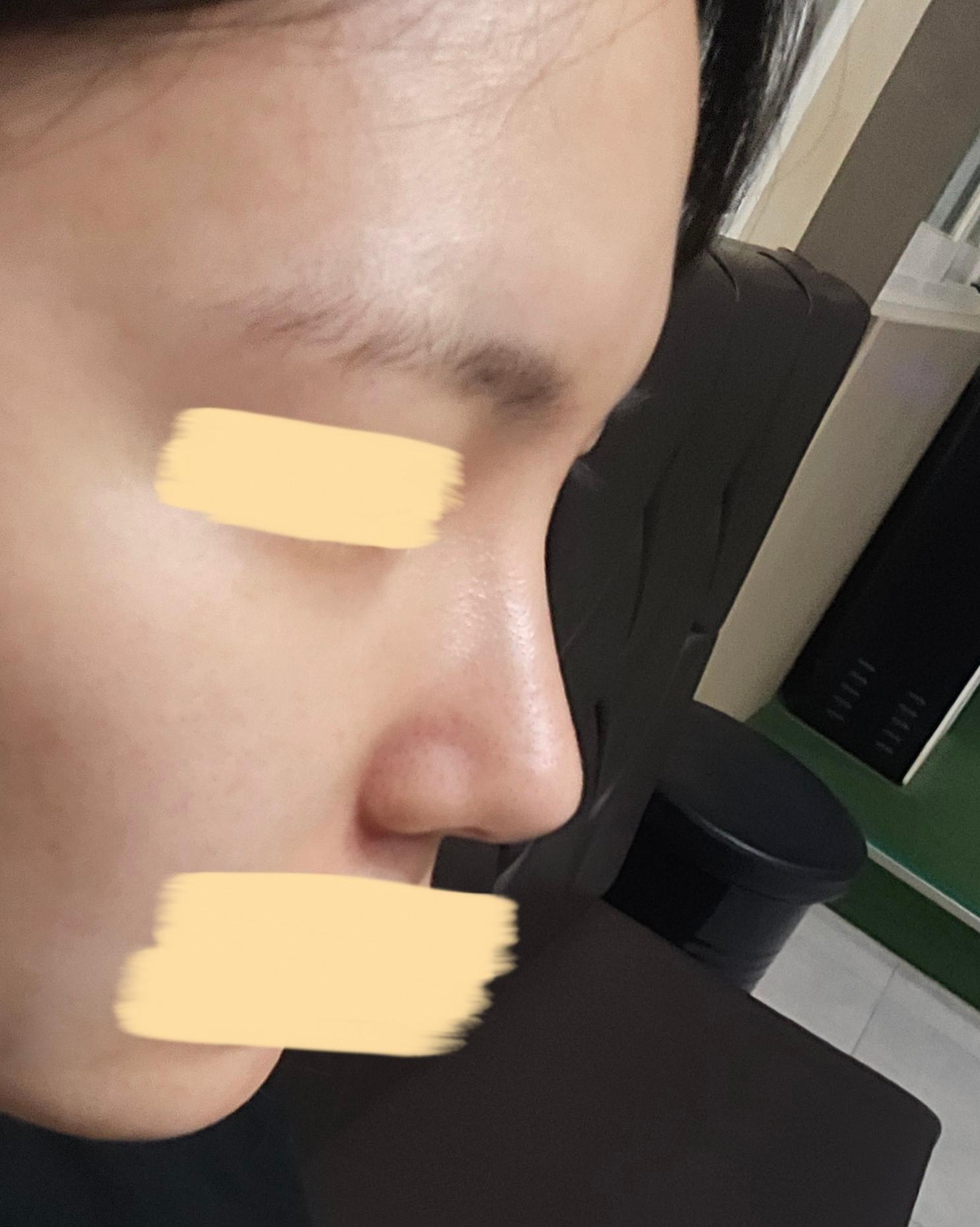 後