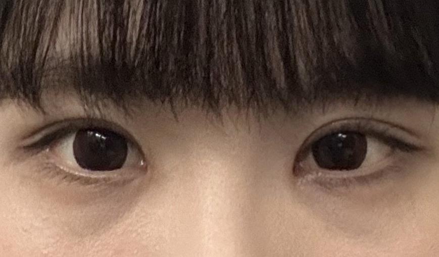 後