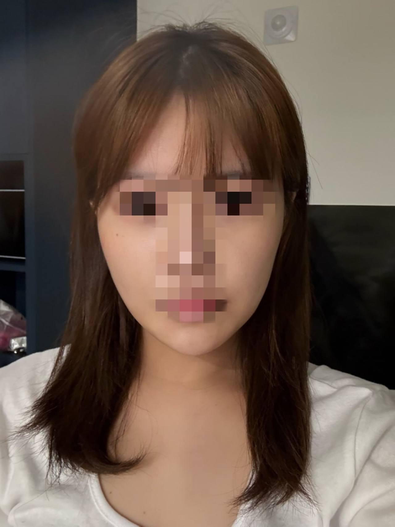 後