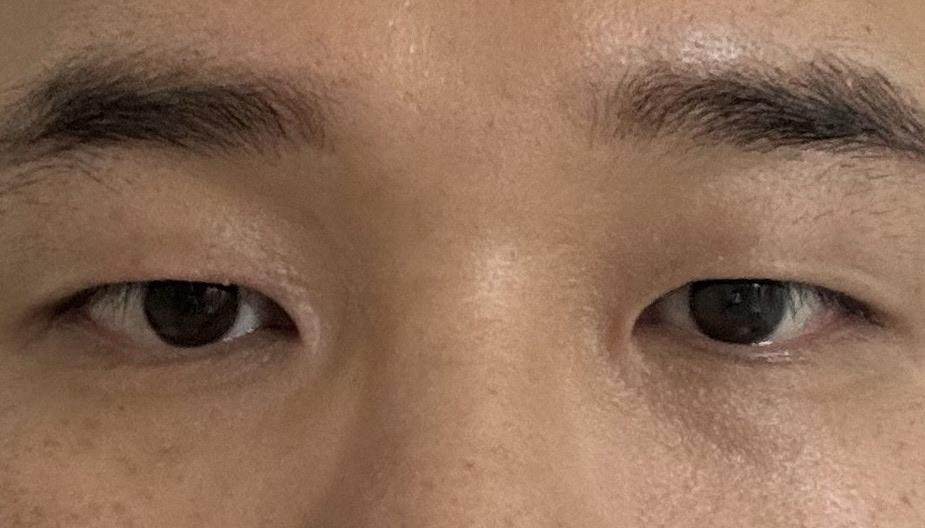 後