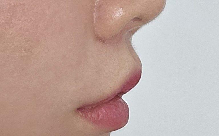 後