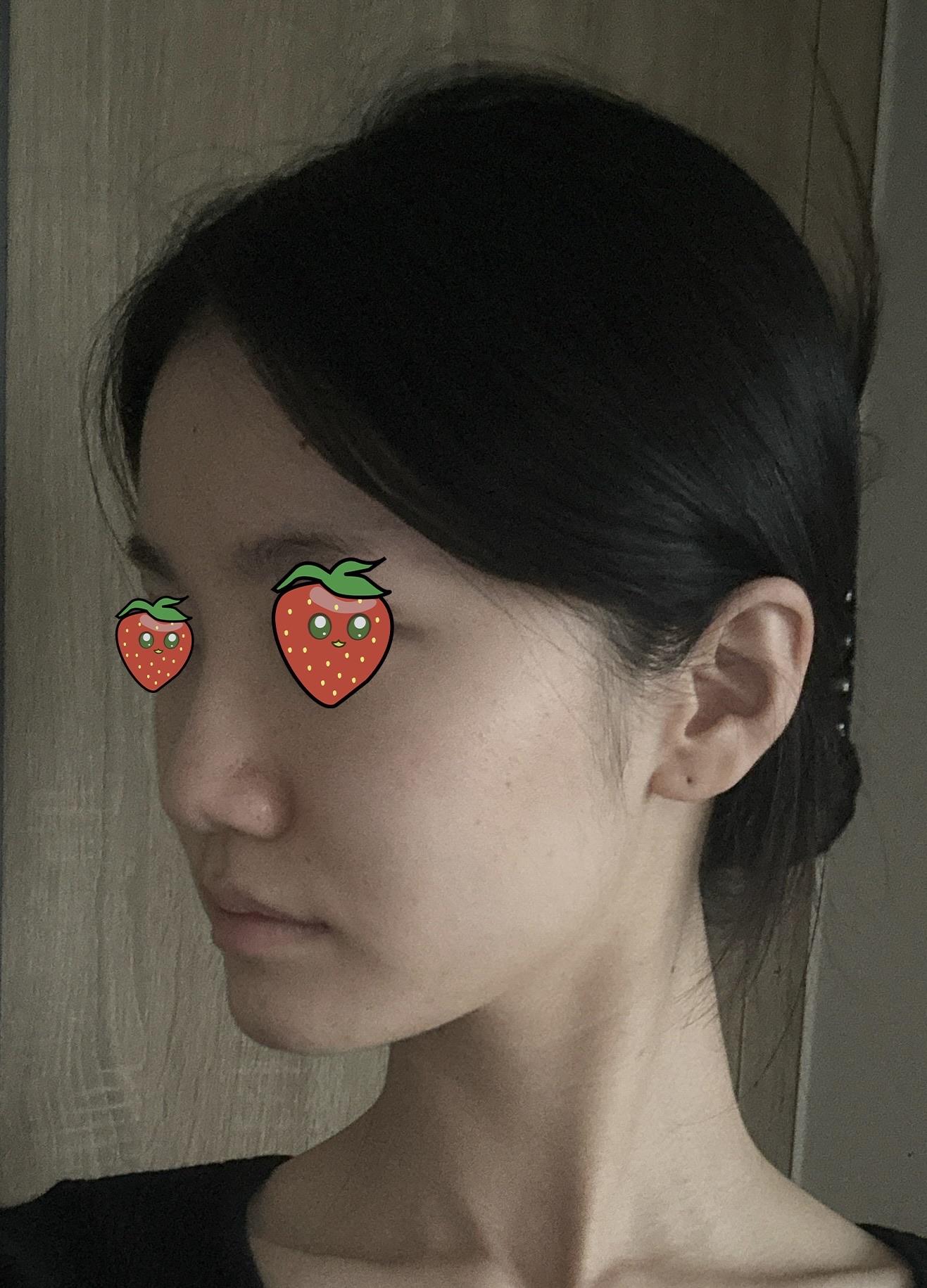 後