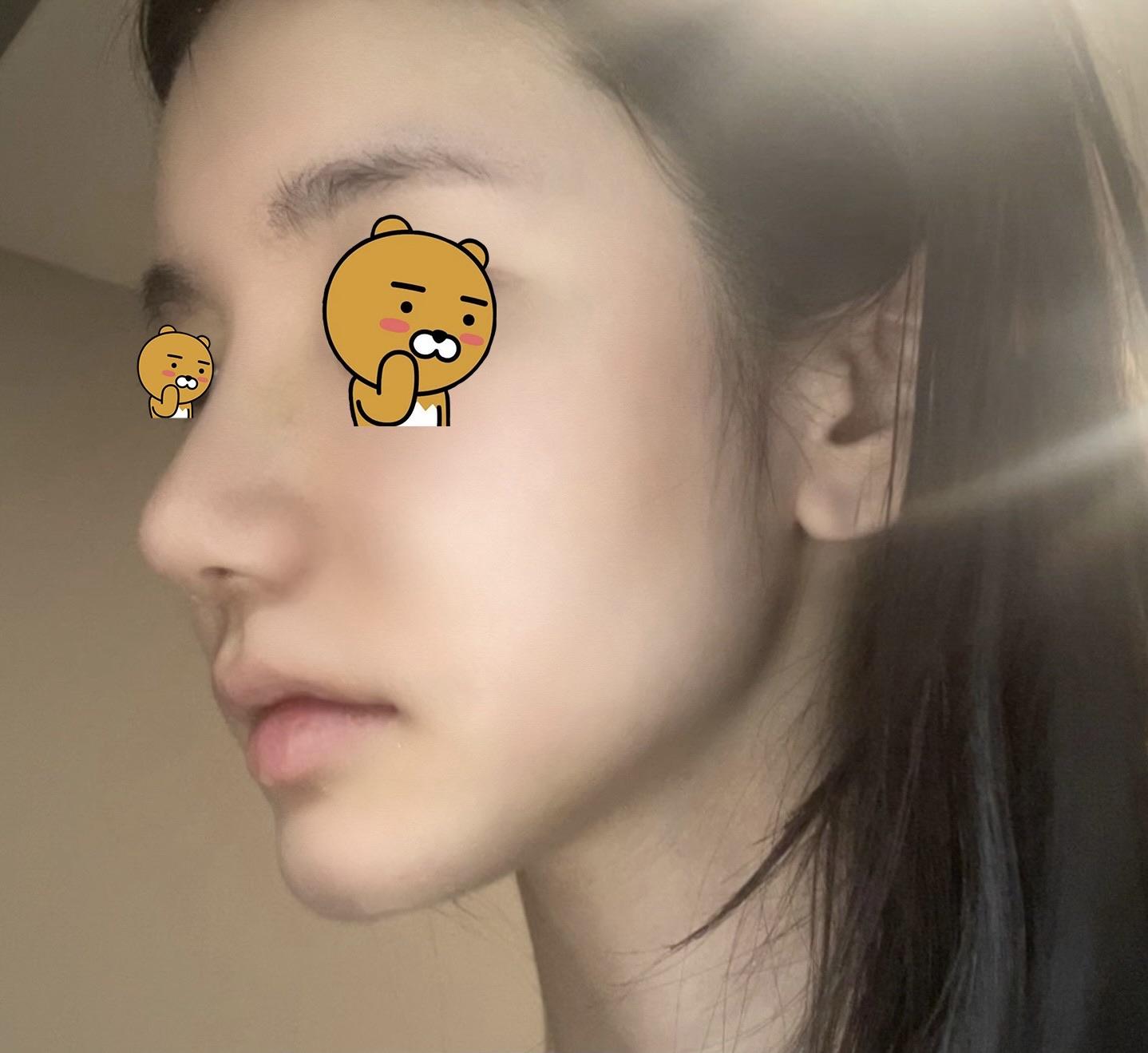 後