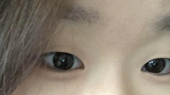 後