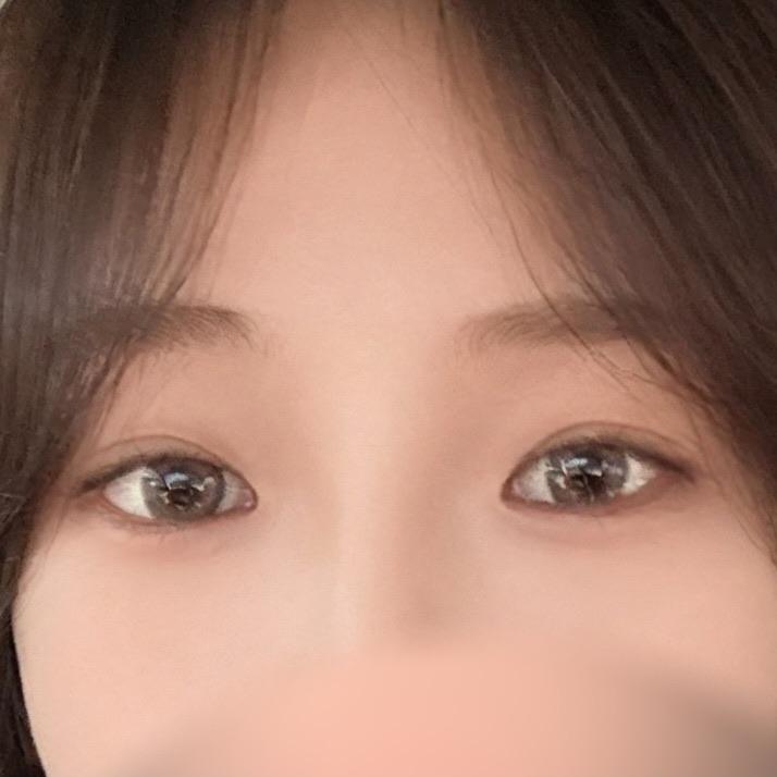 後