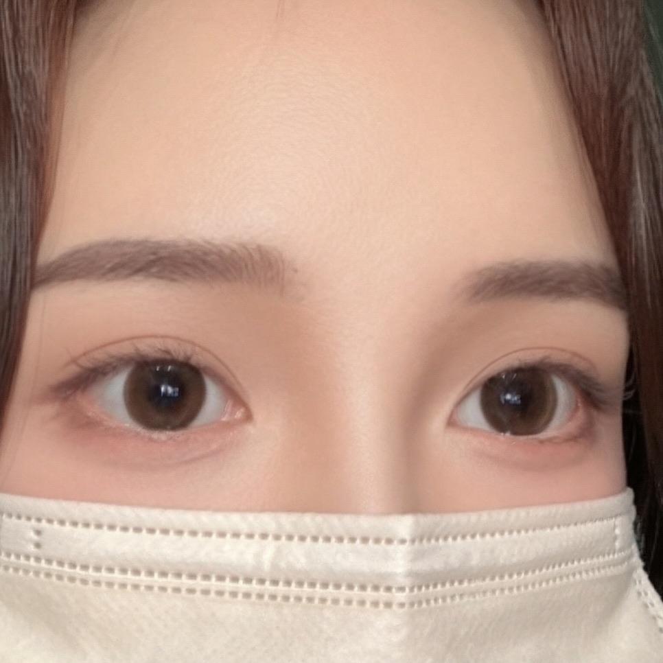 後