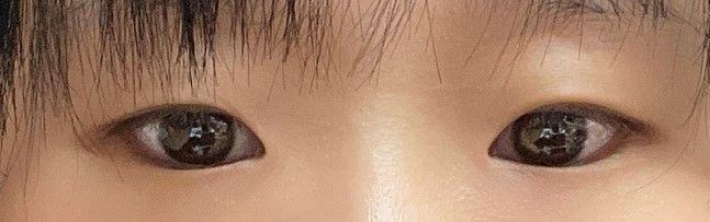後