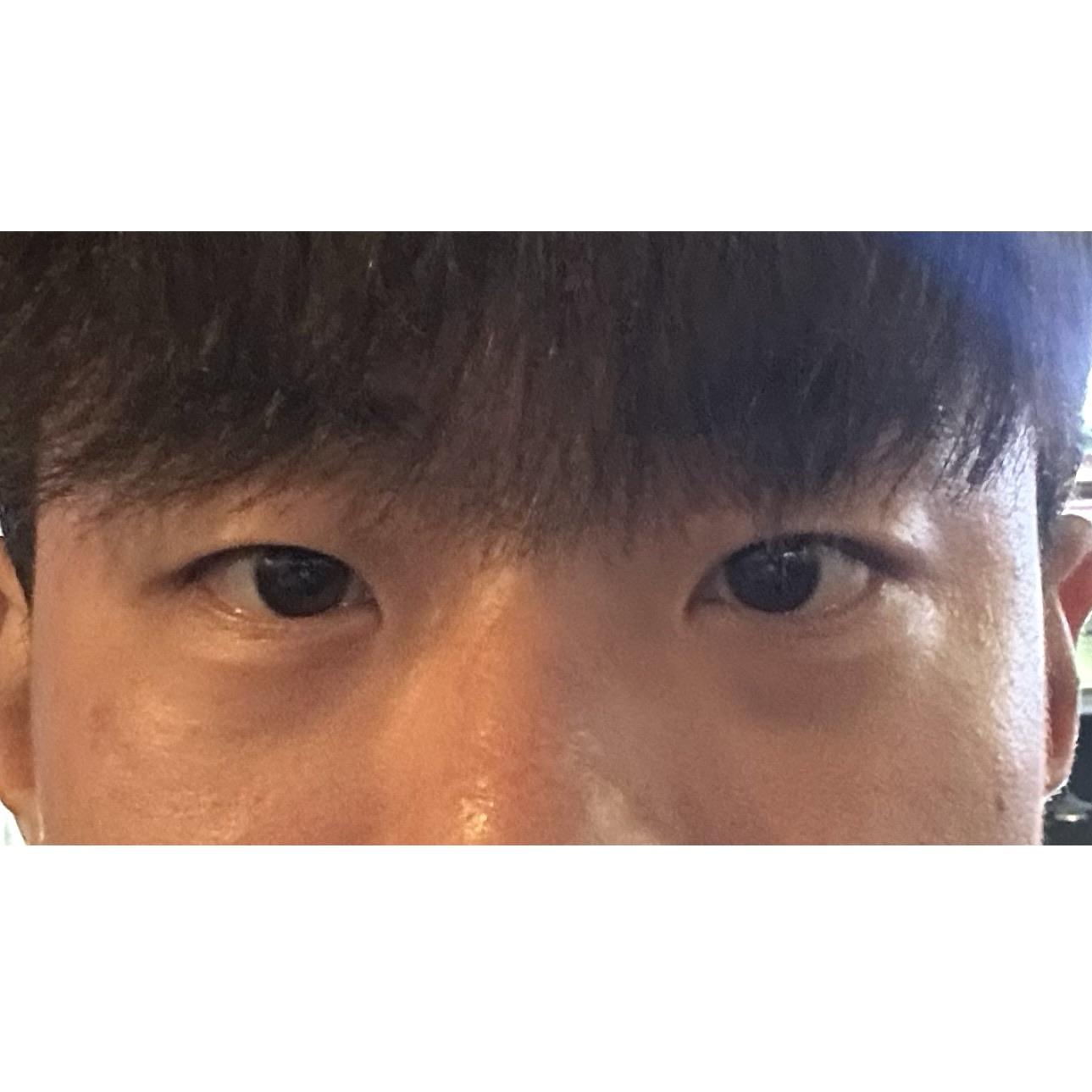 後