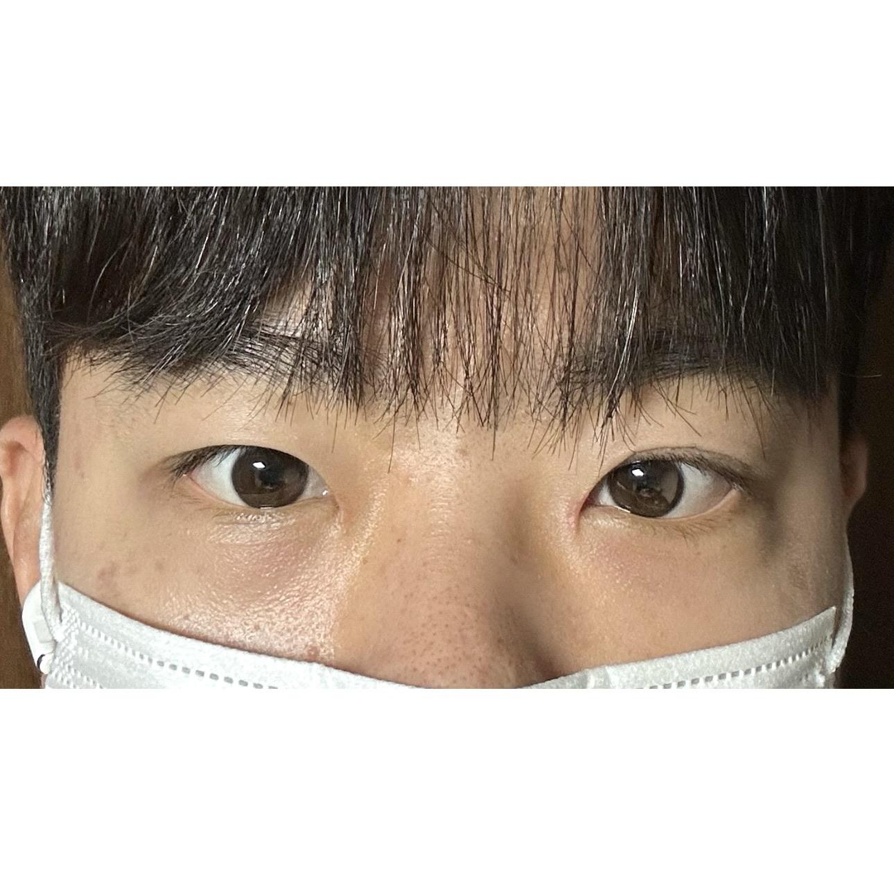 後