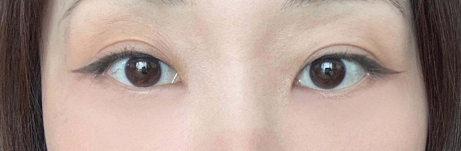 後