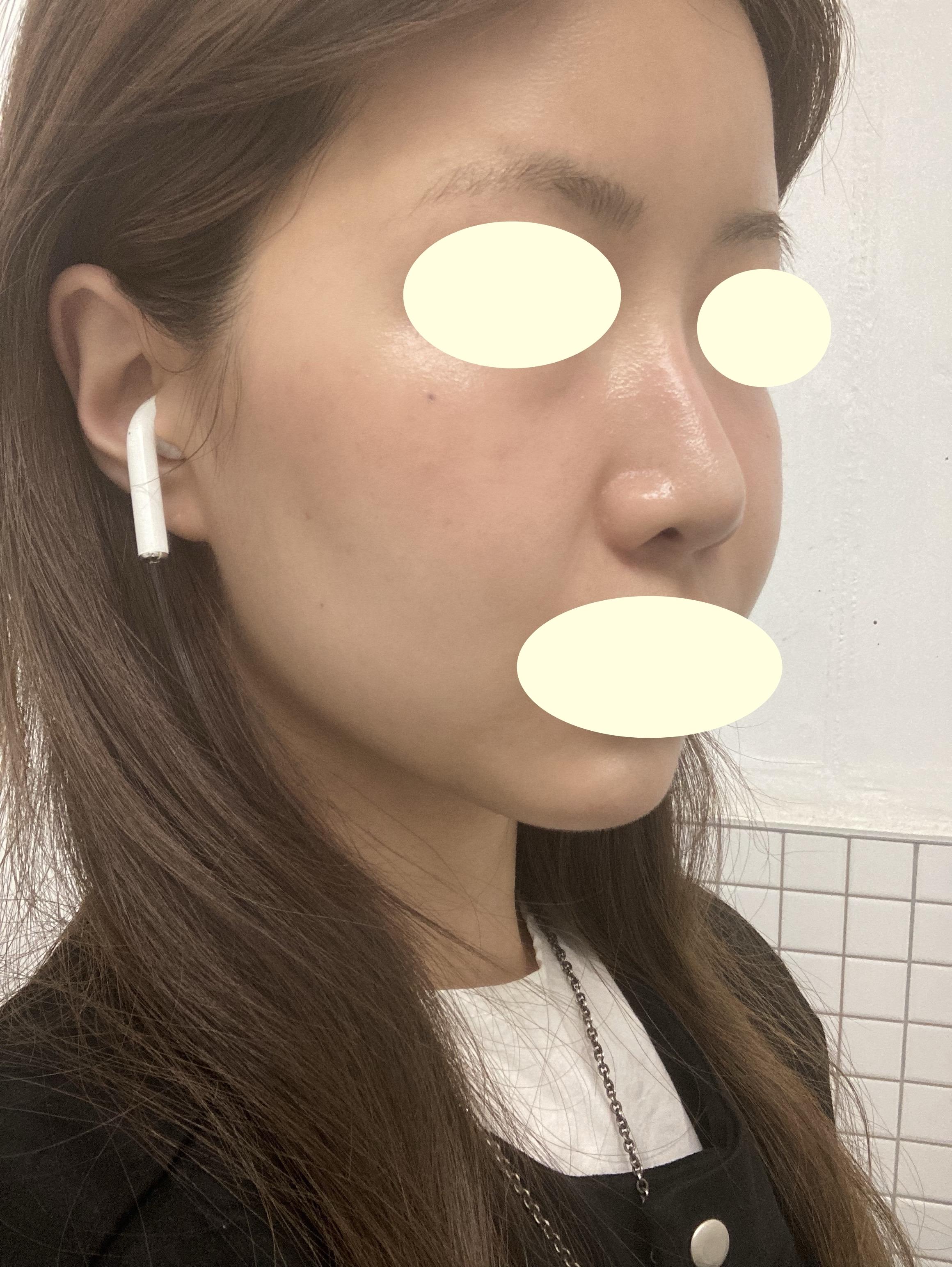 後