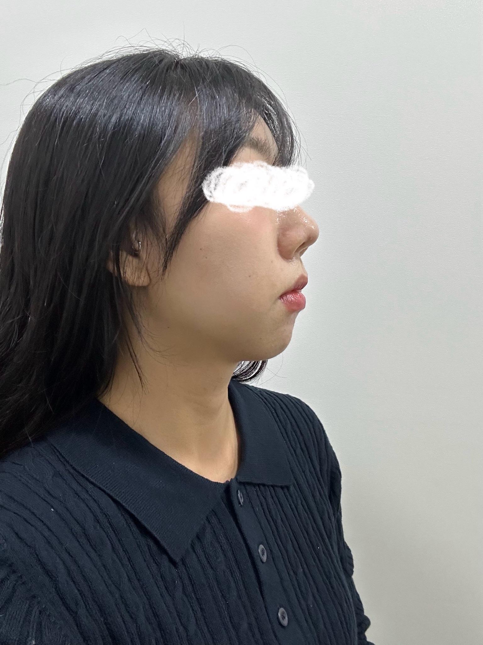 後