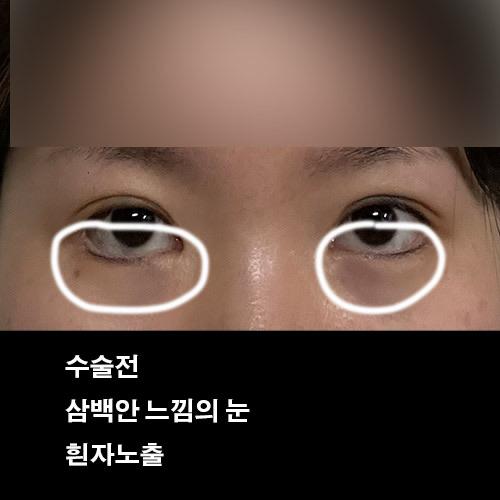 後