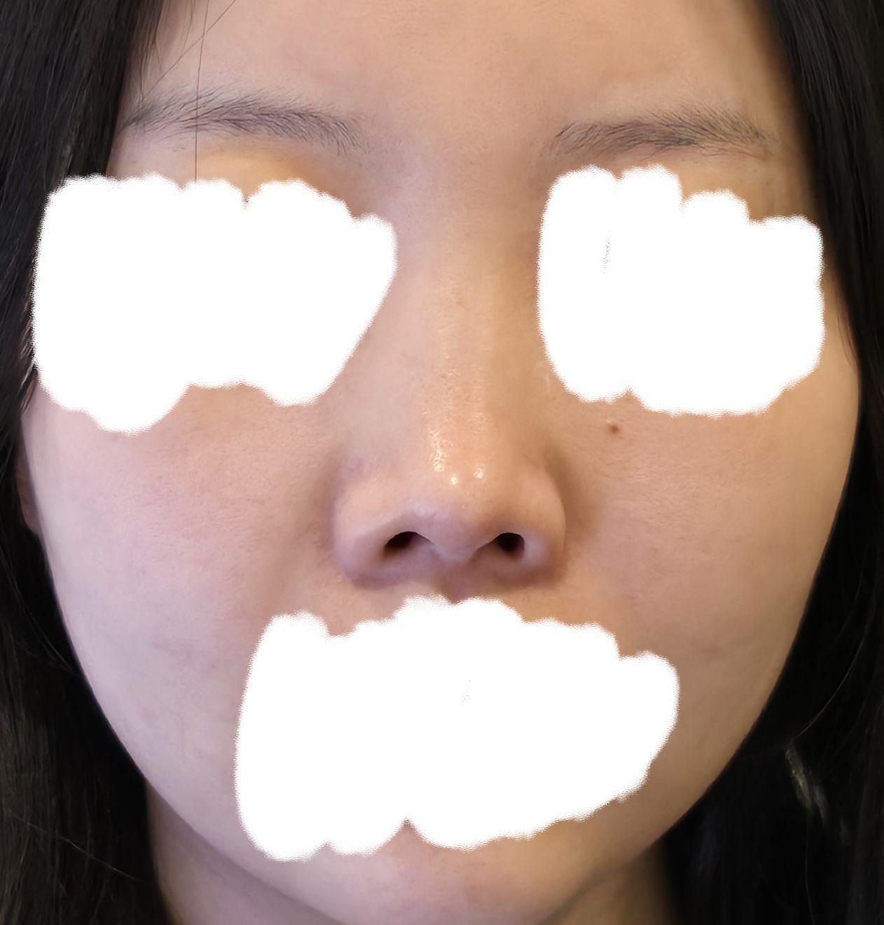 後