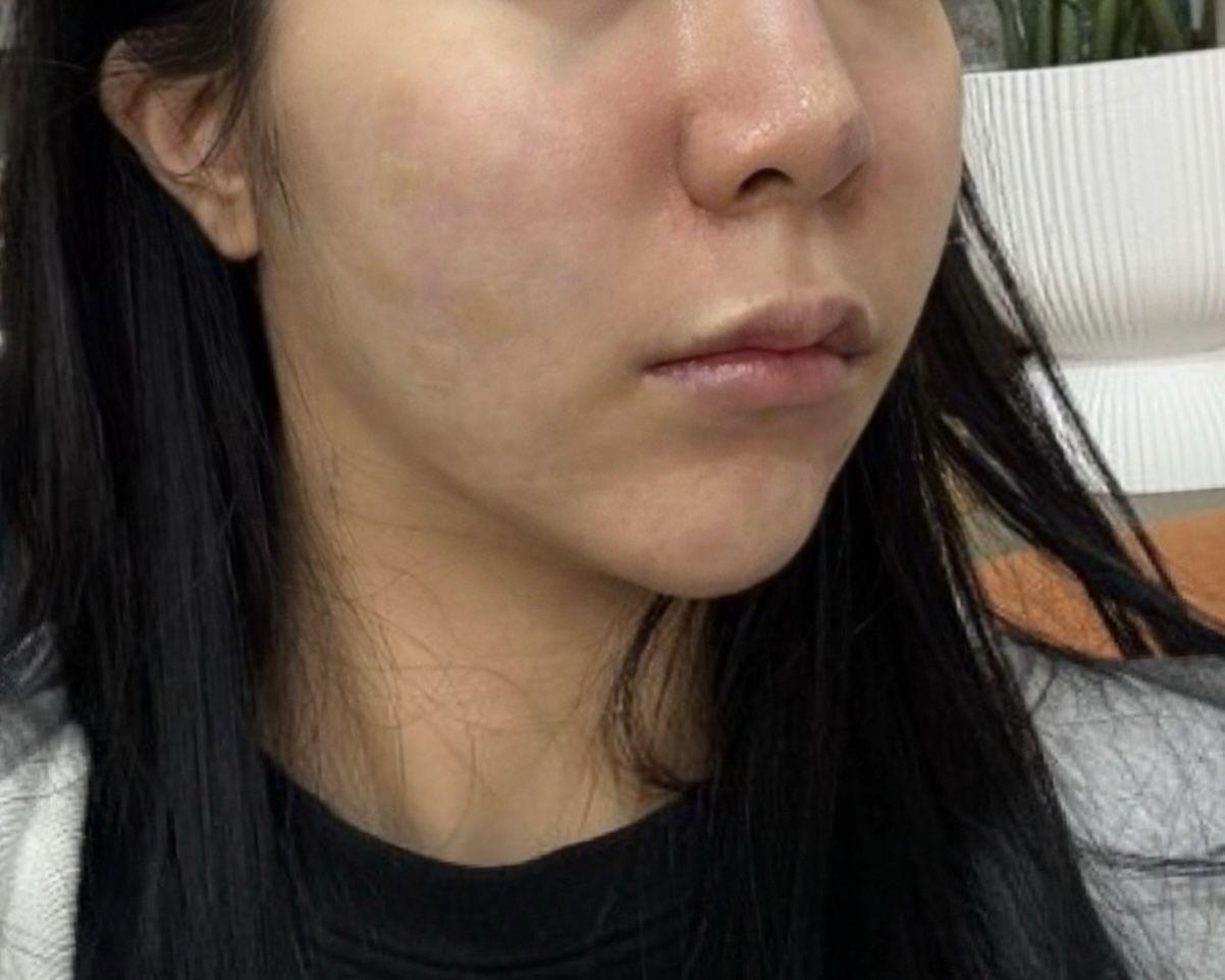後