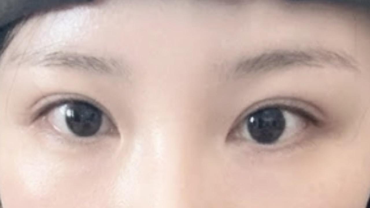後