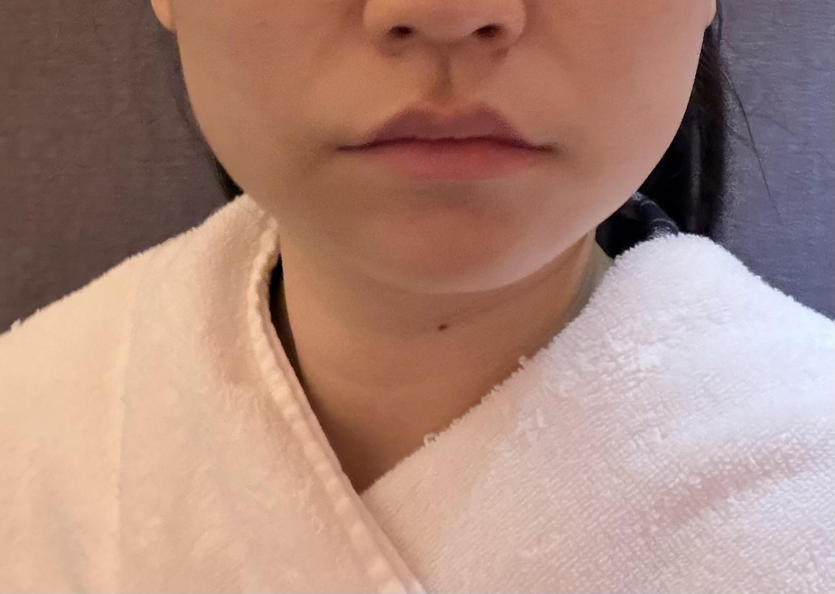 後