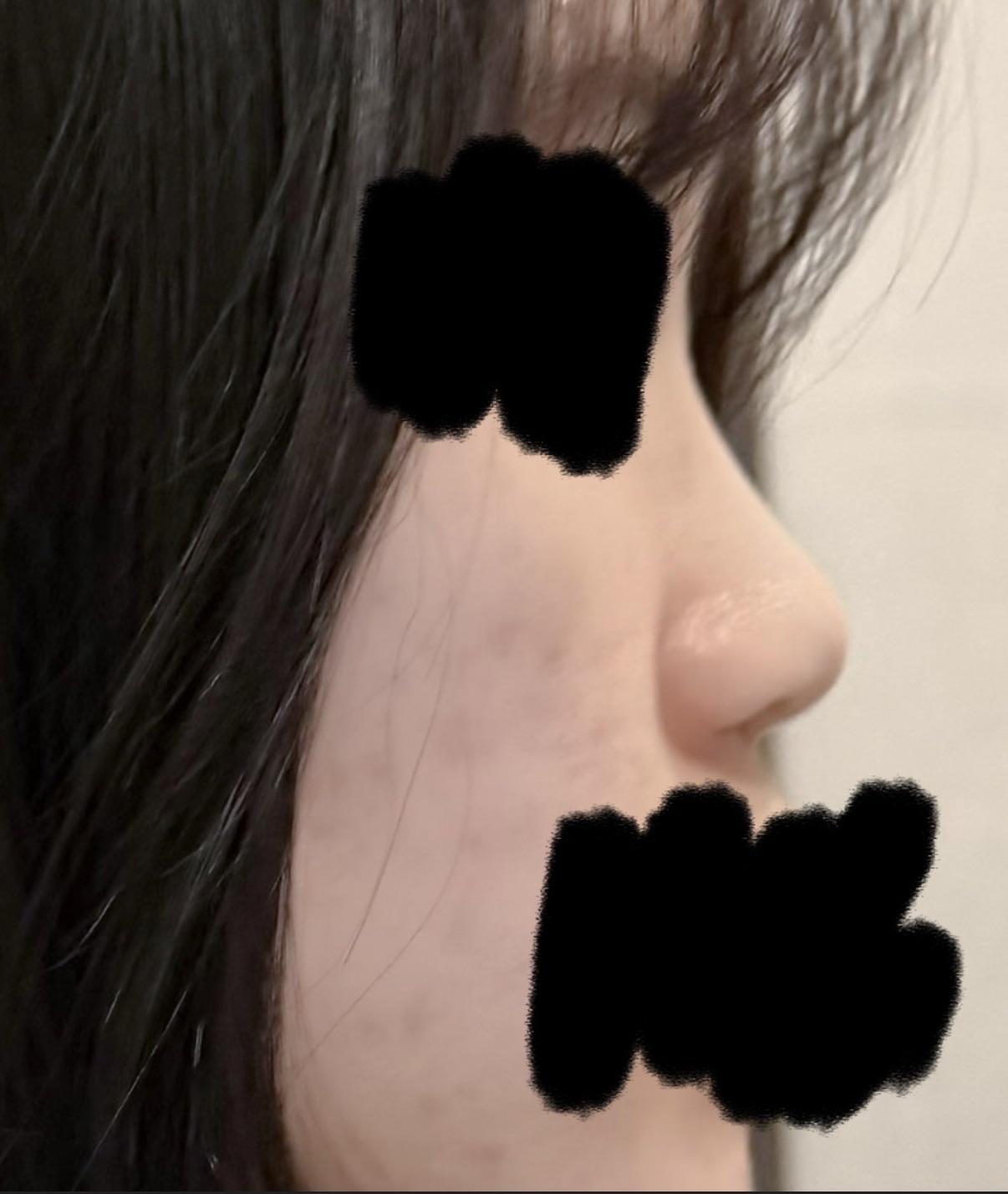 後