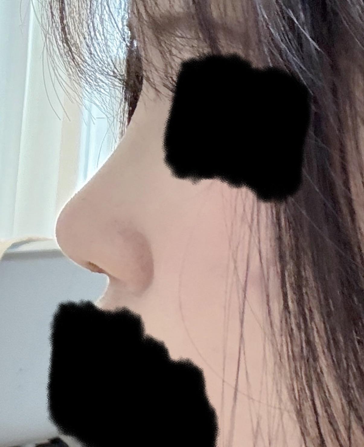 後