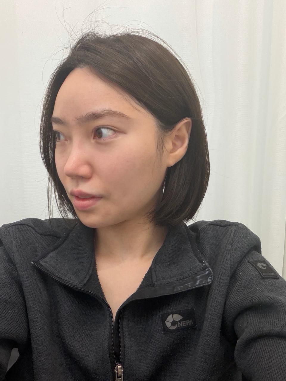 後