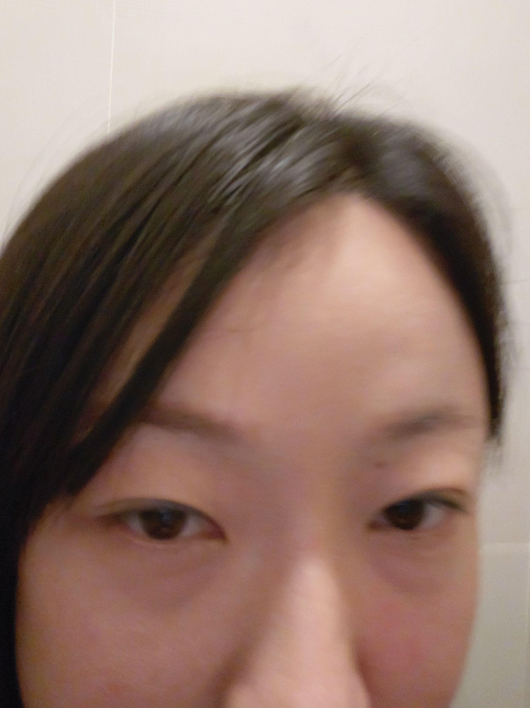 後