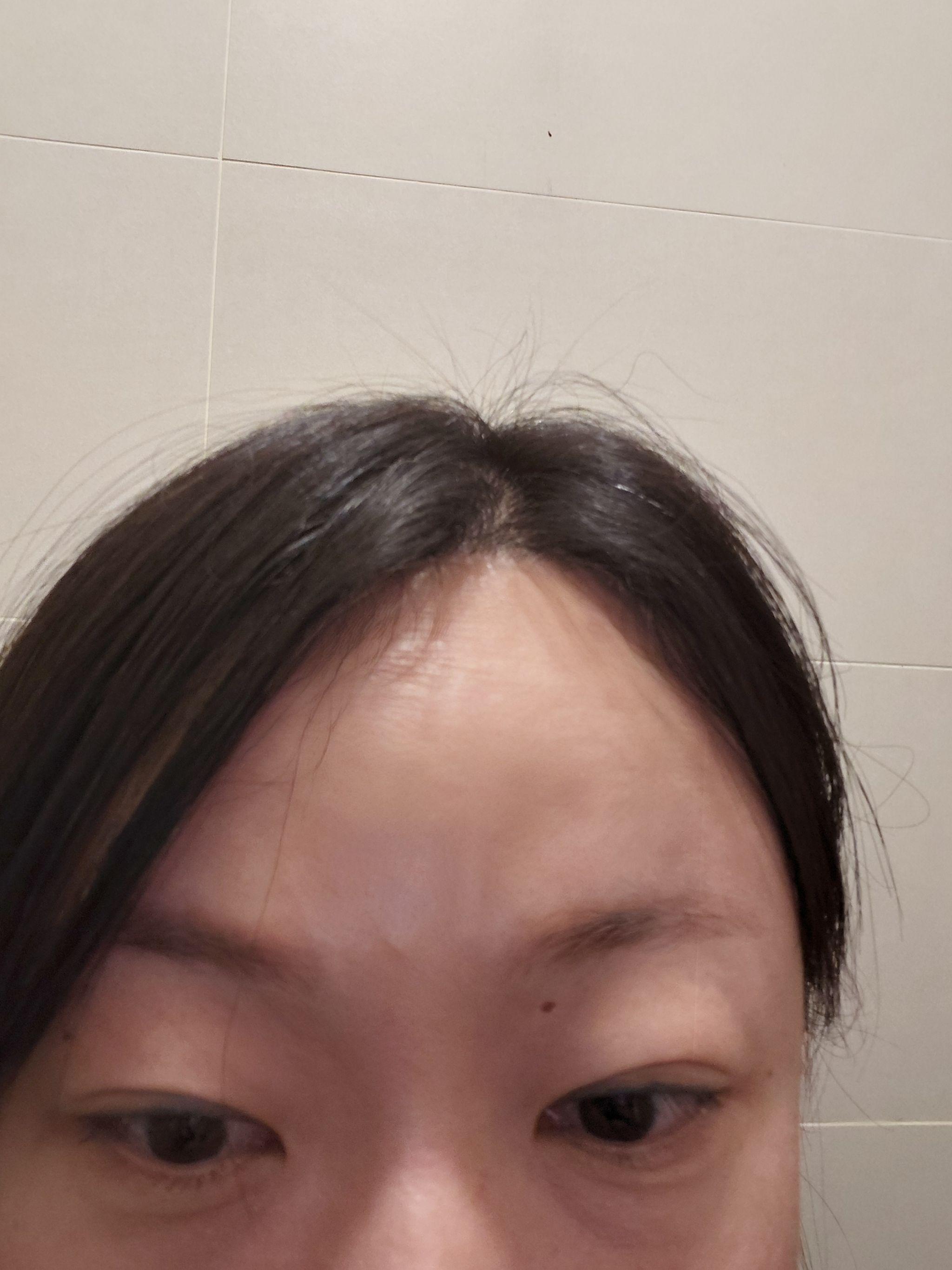 後