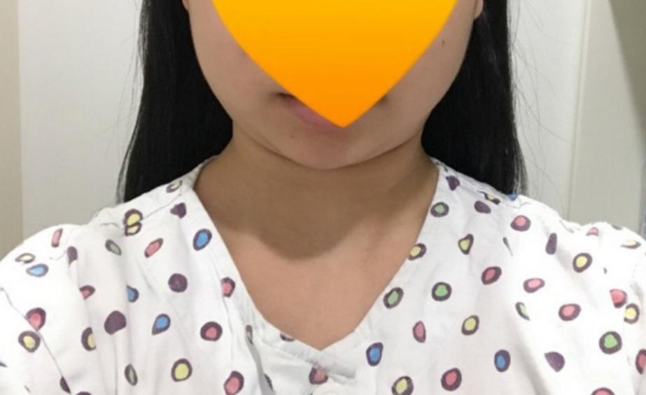 後