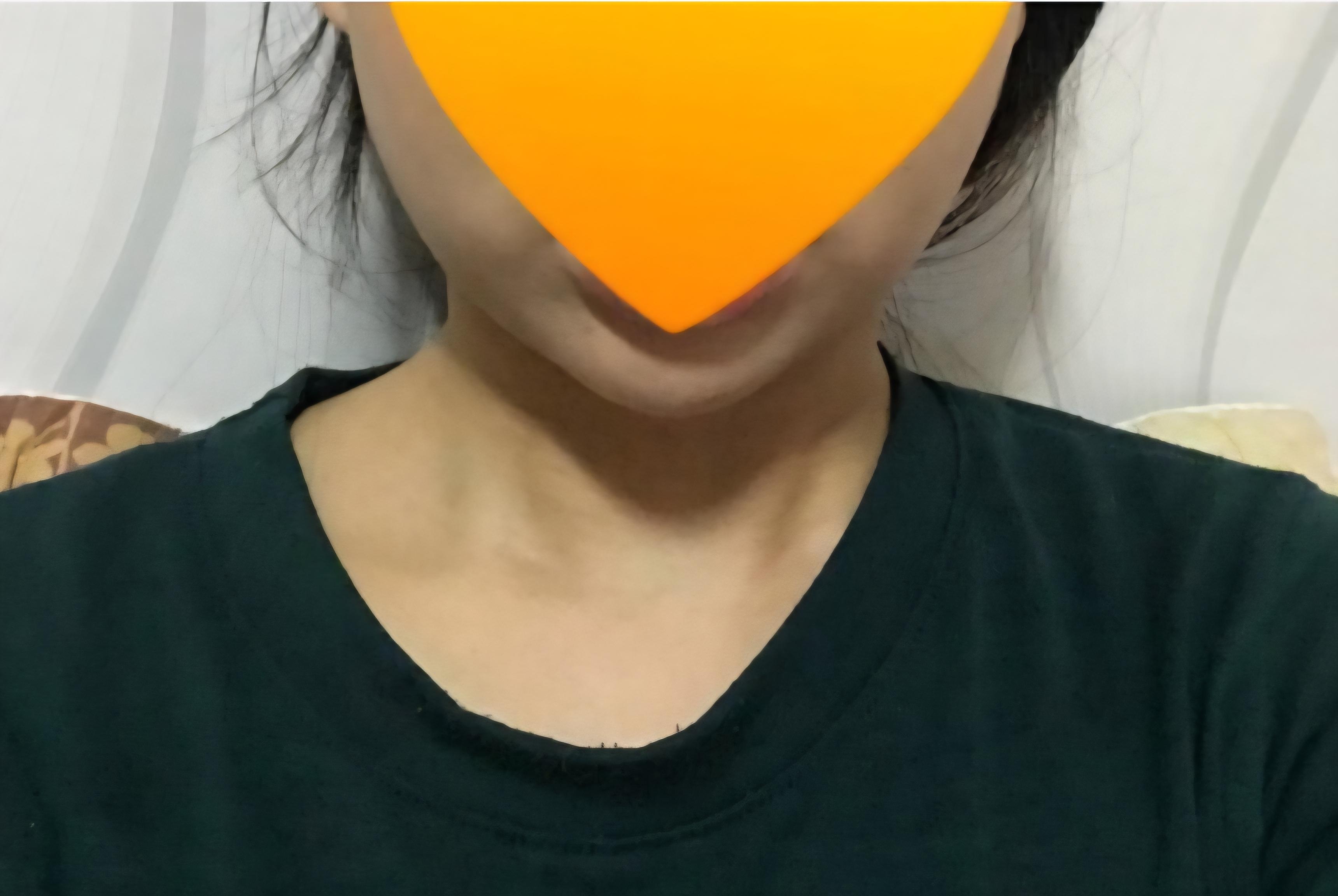 後