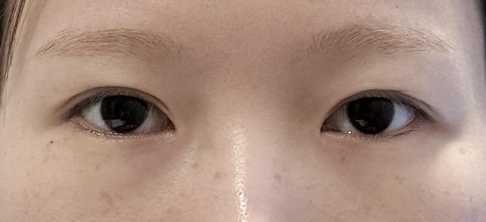 前