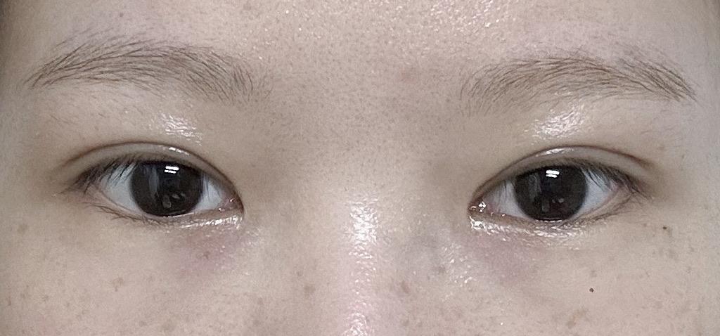 後