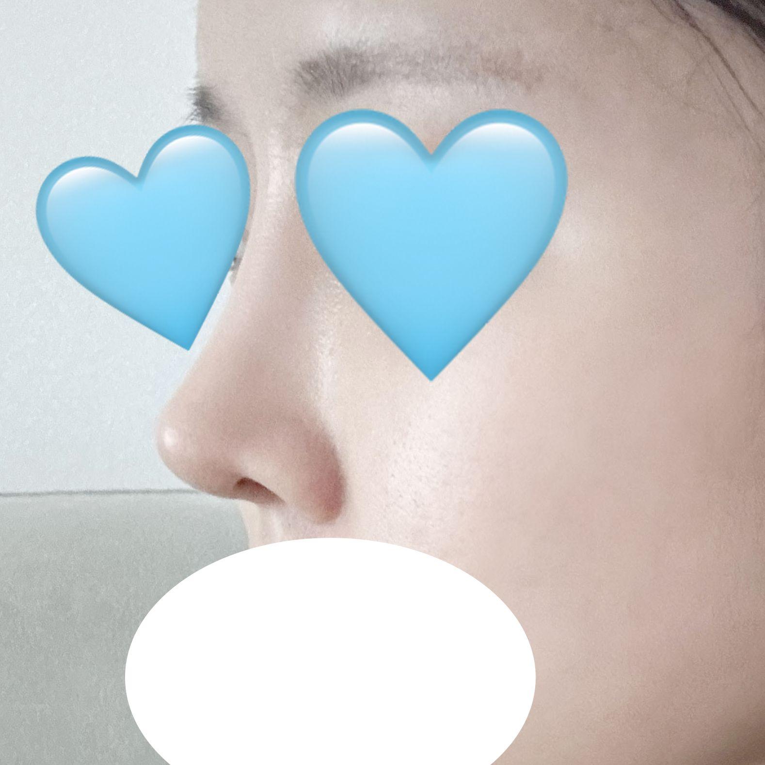 後