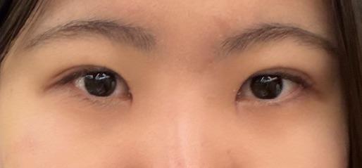 後