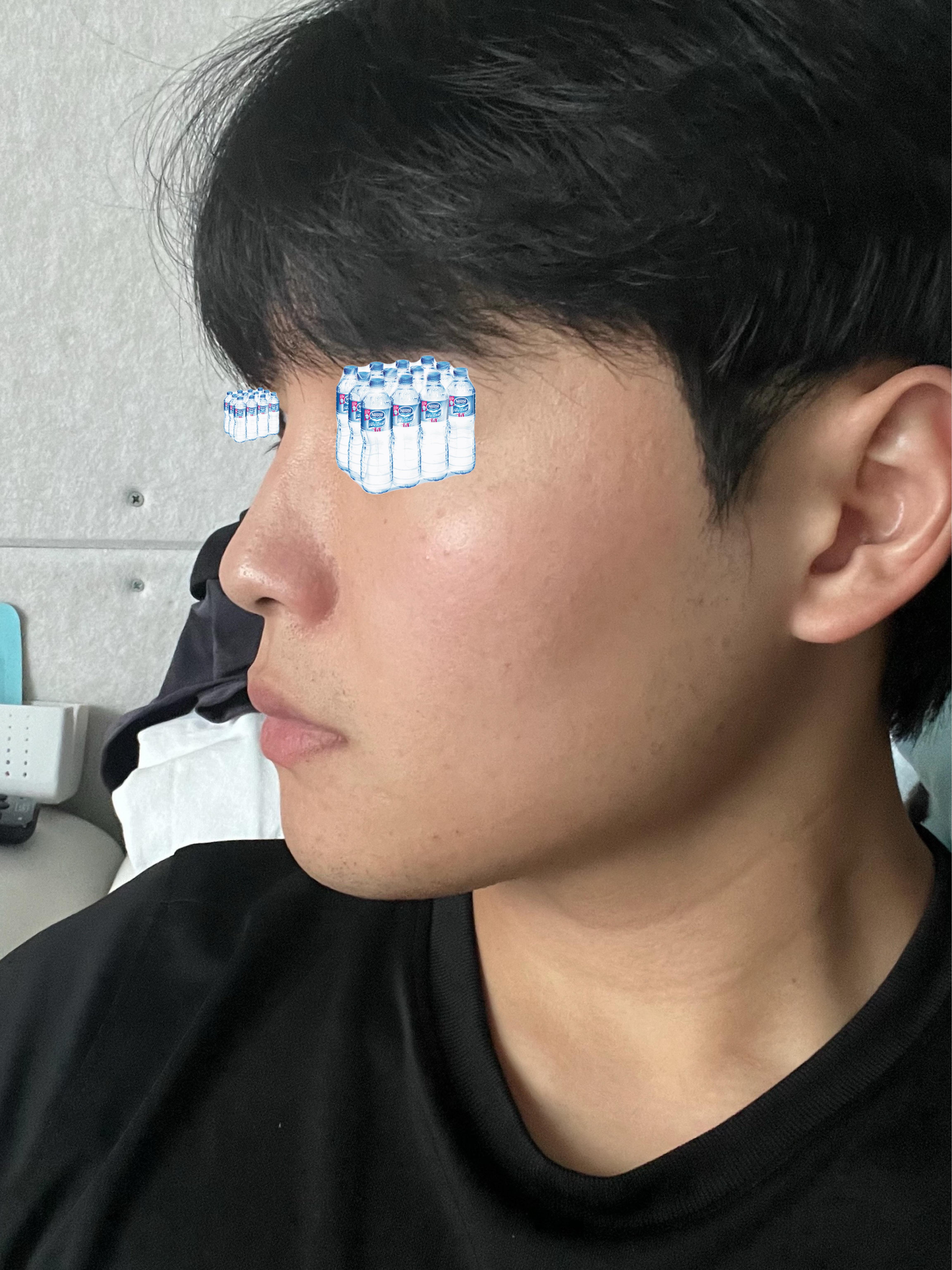 後