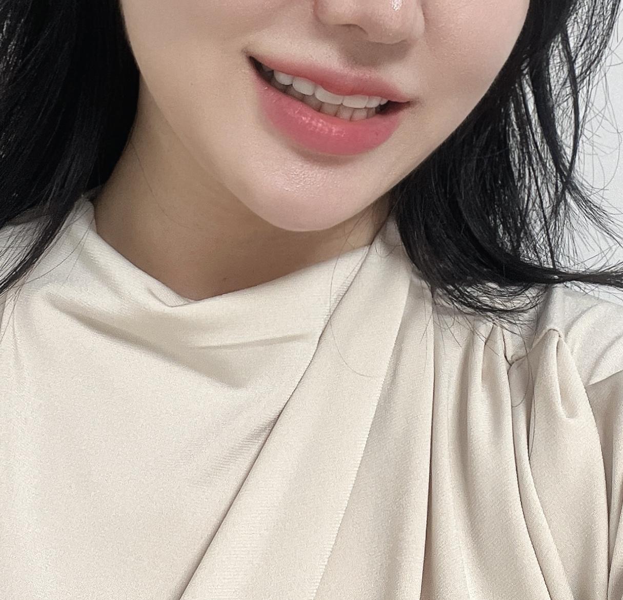 後