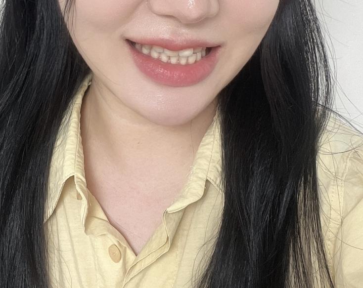 後