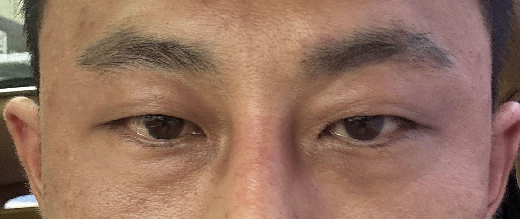 後