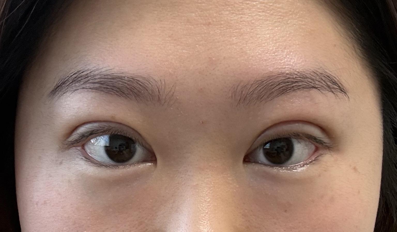 After