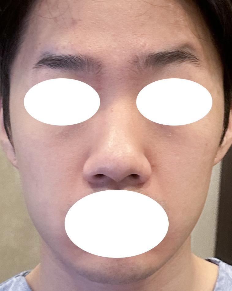 後
