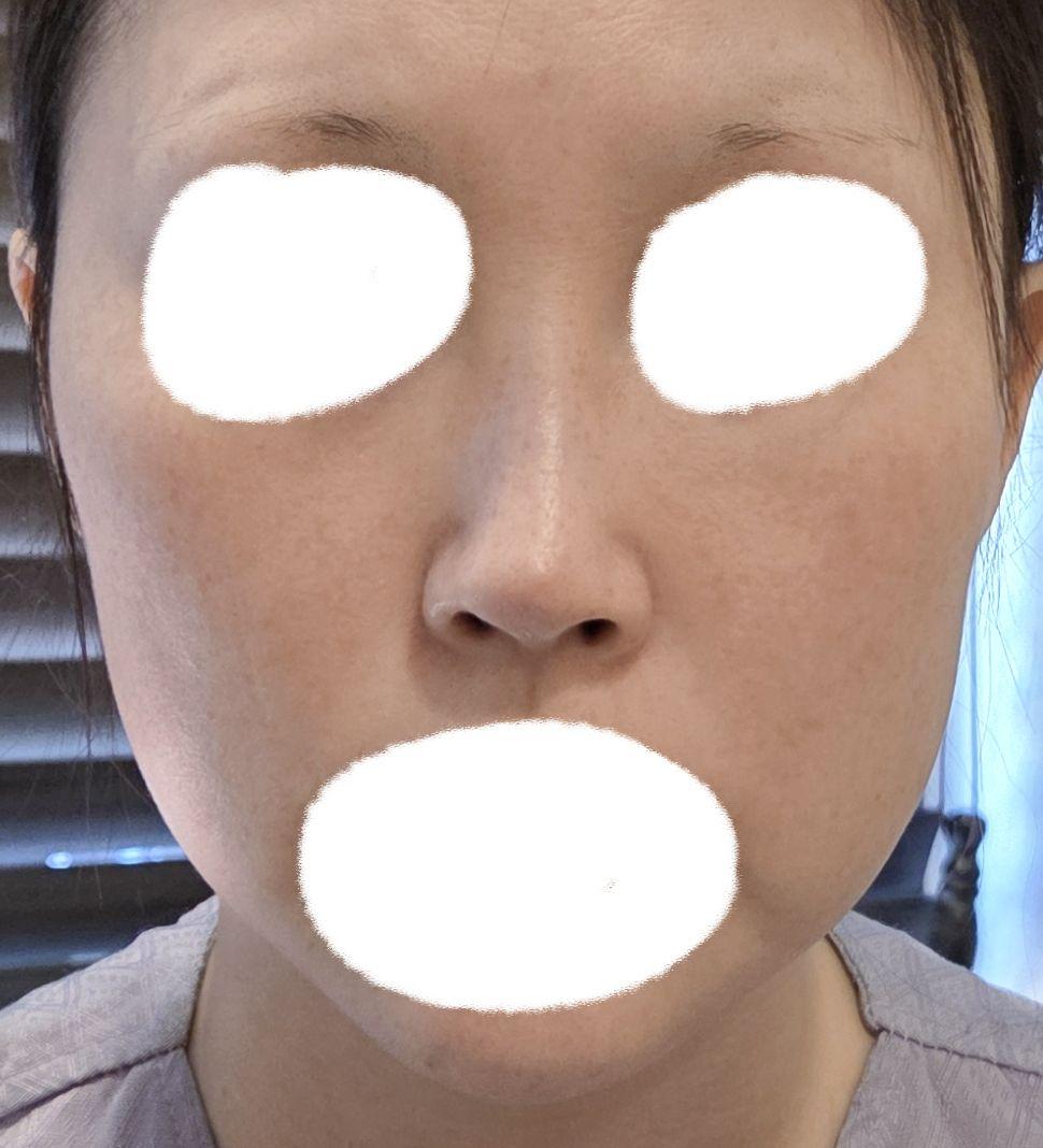 後