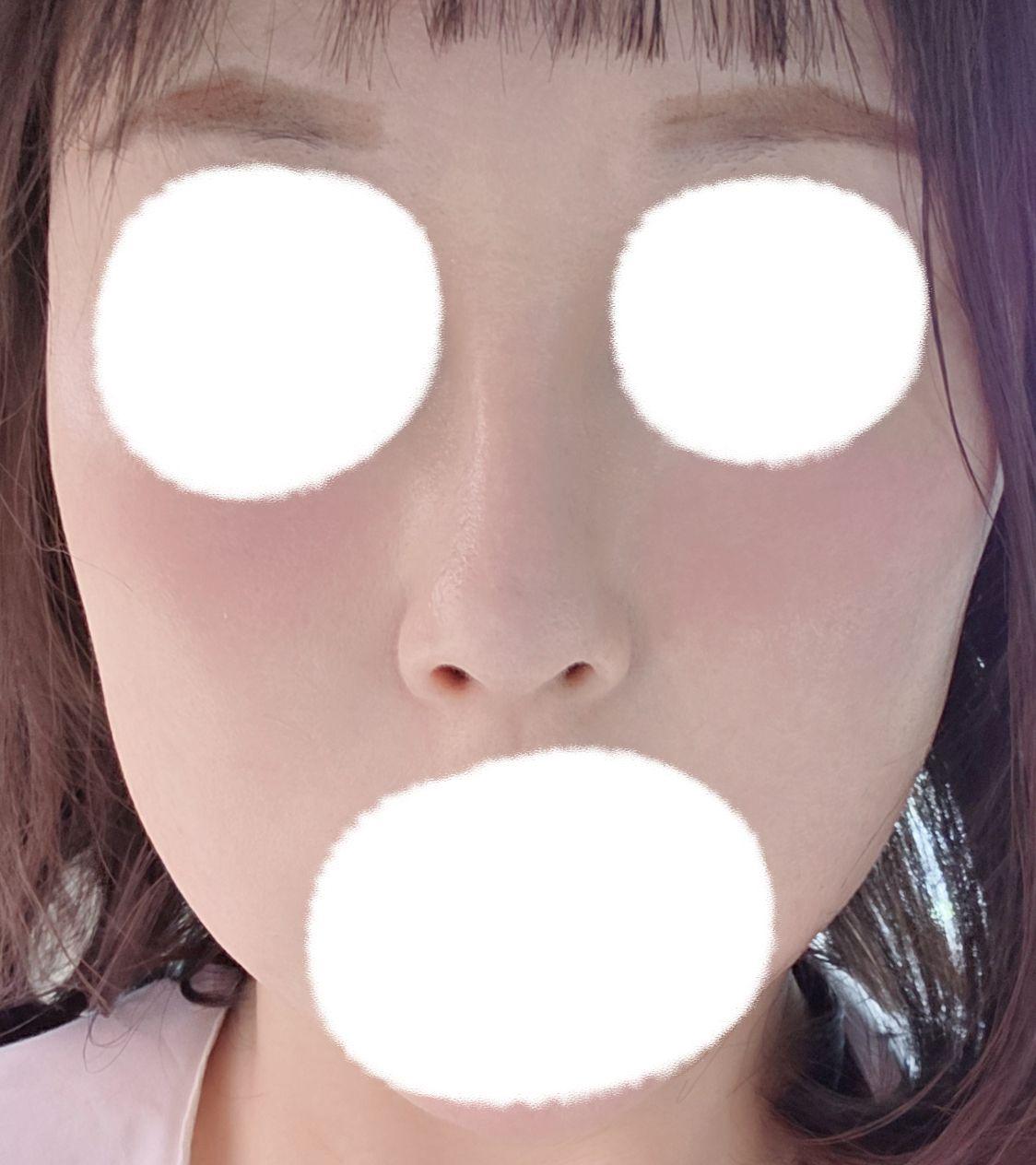 後