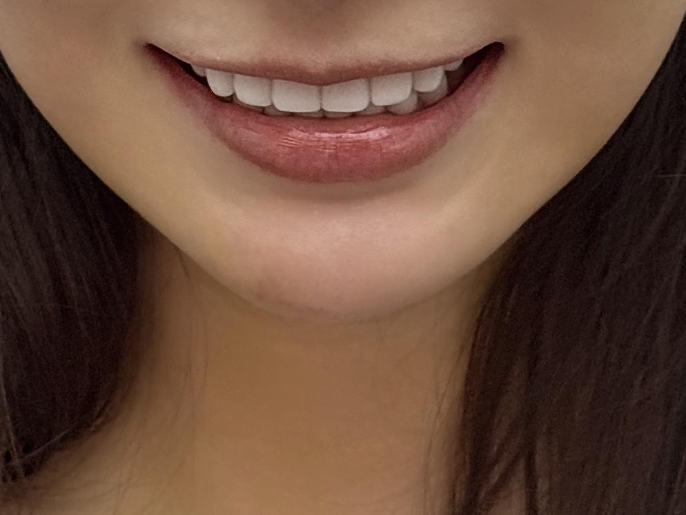 後