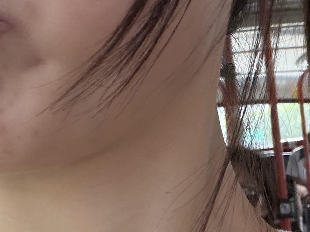 後