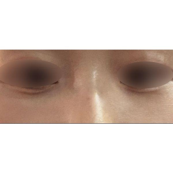 后