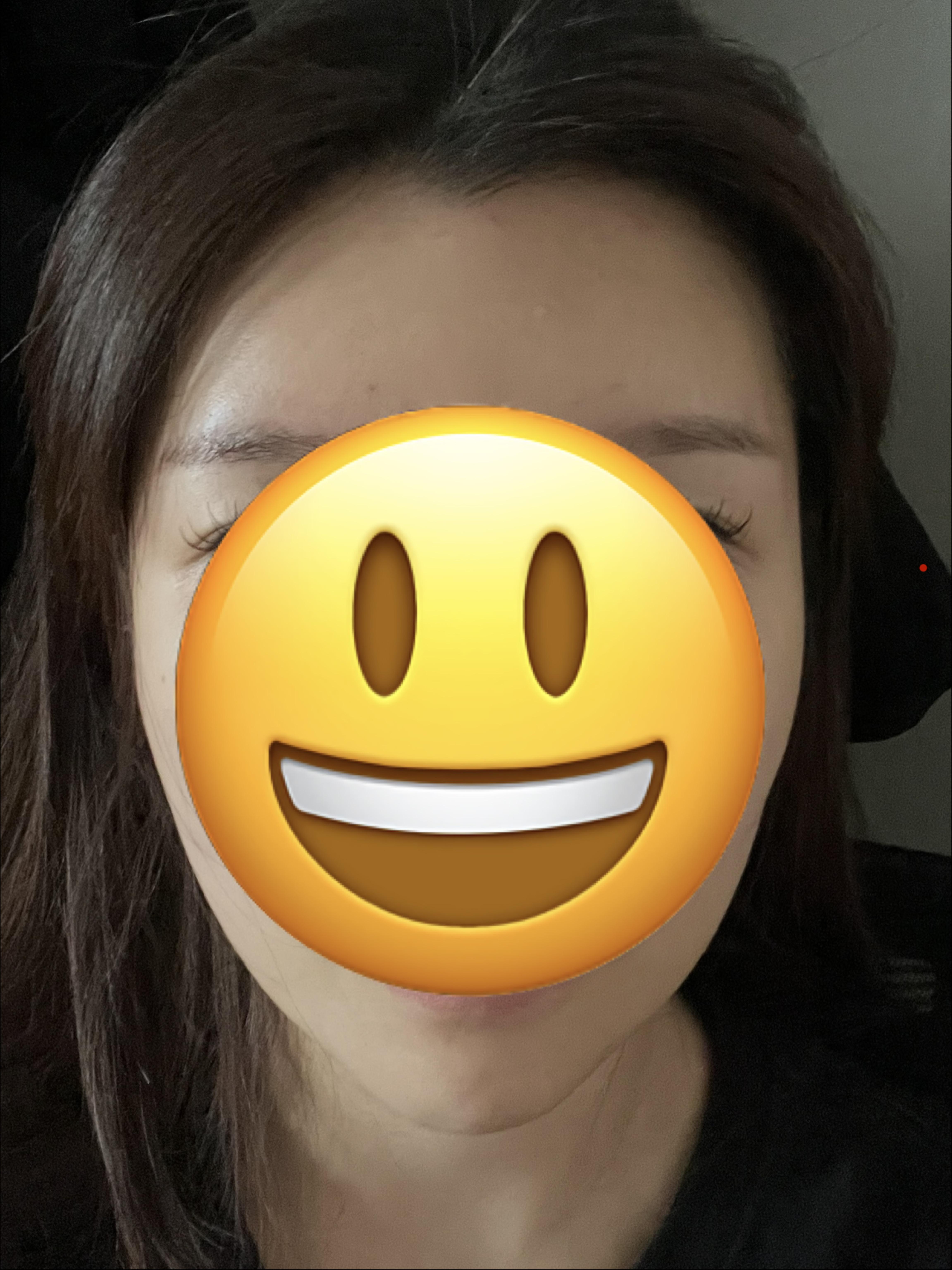 後