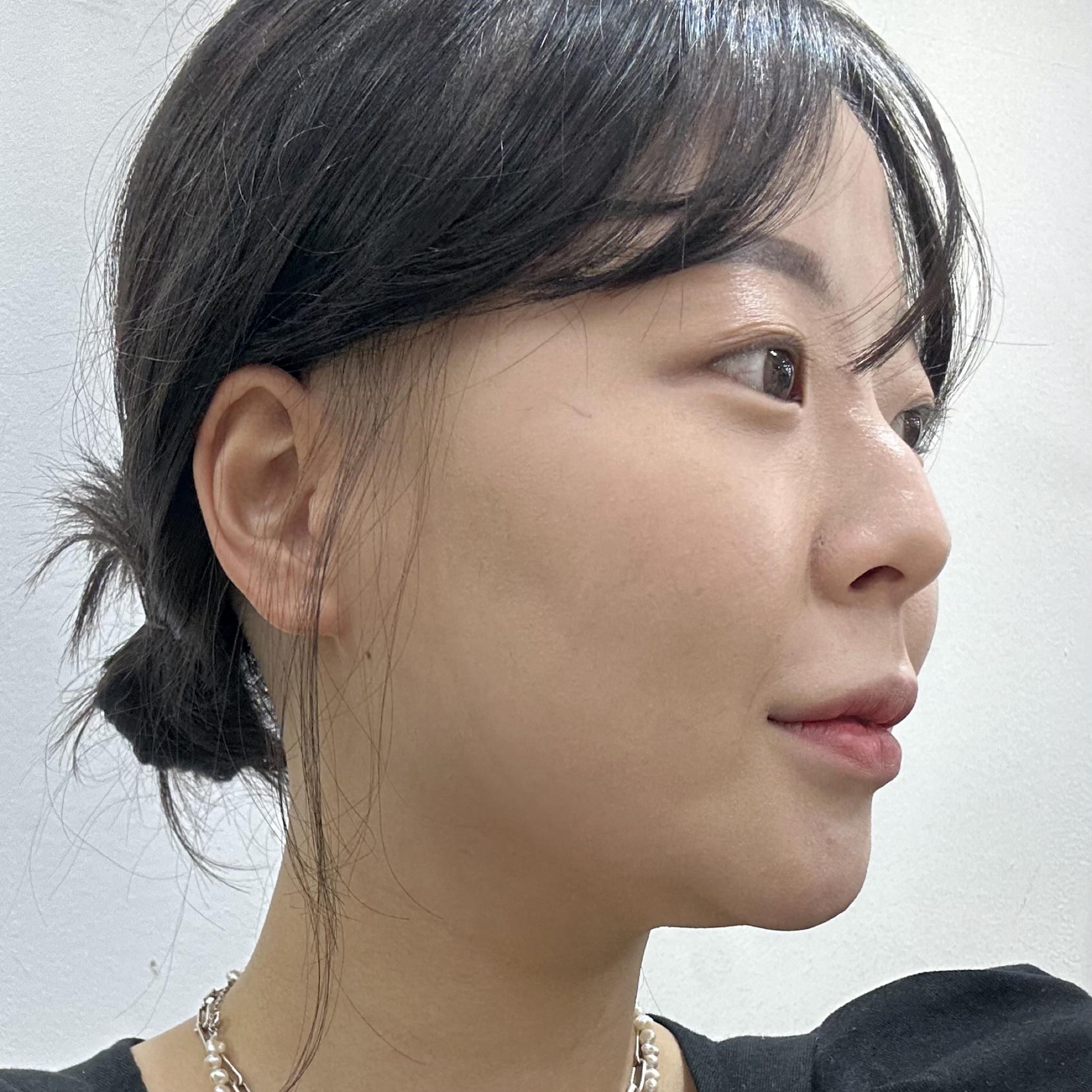 後