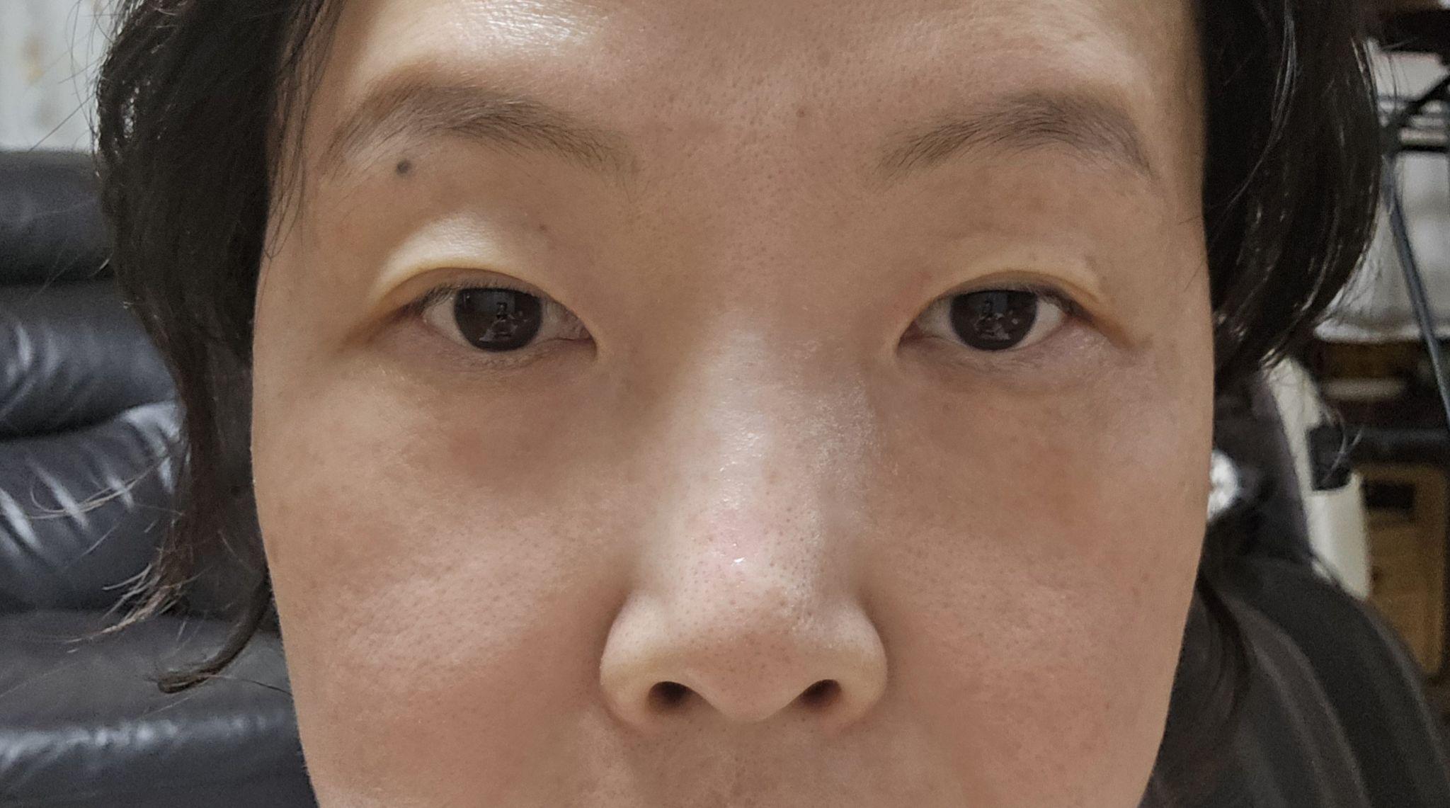 後