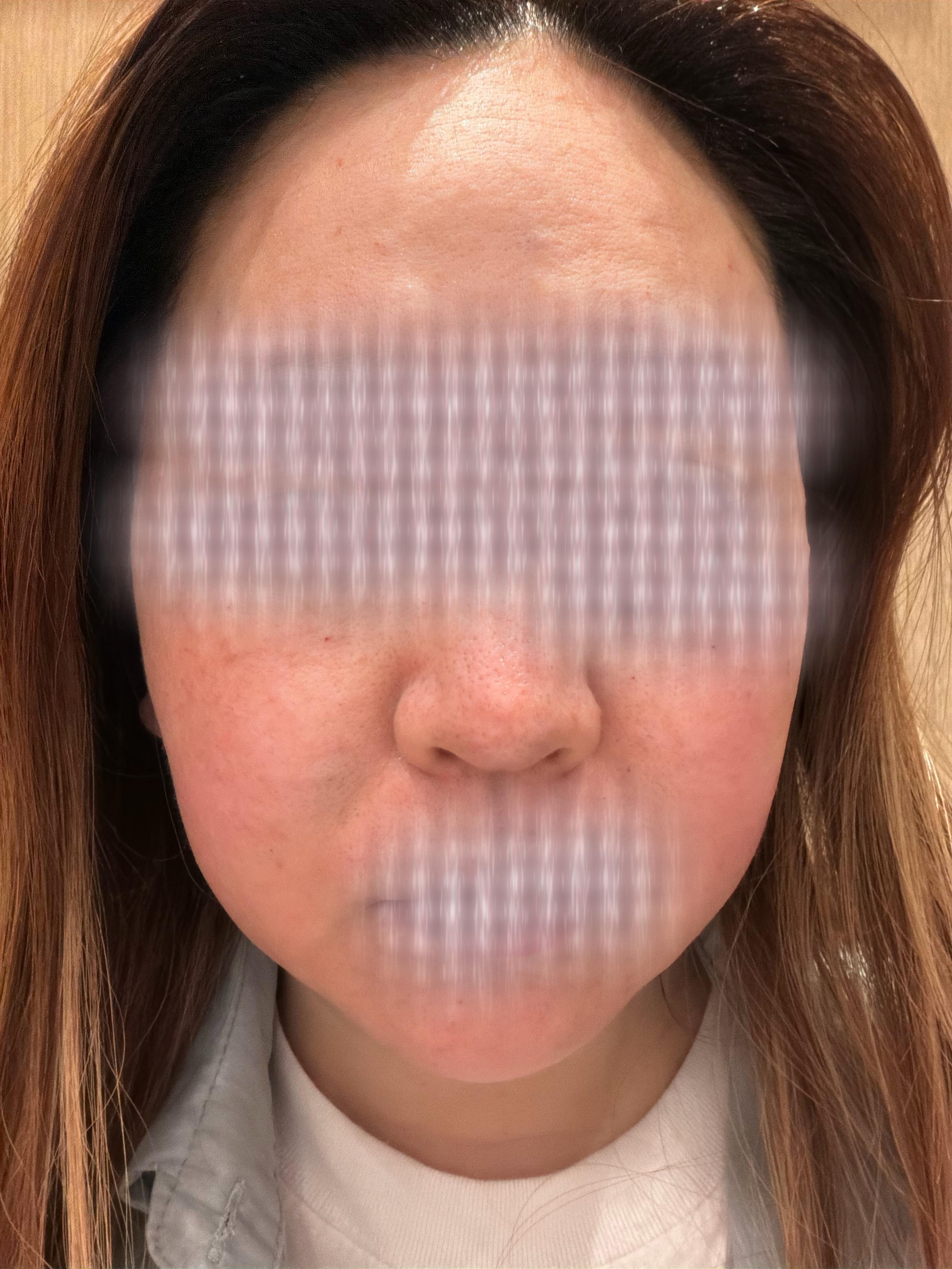 後