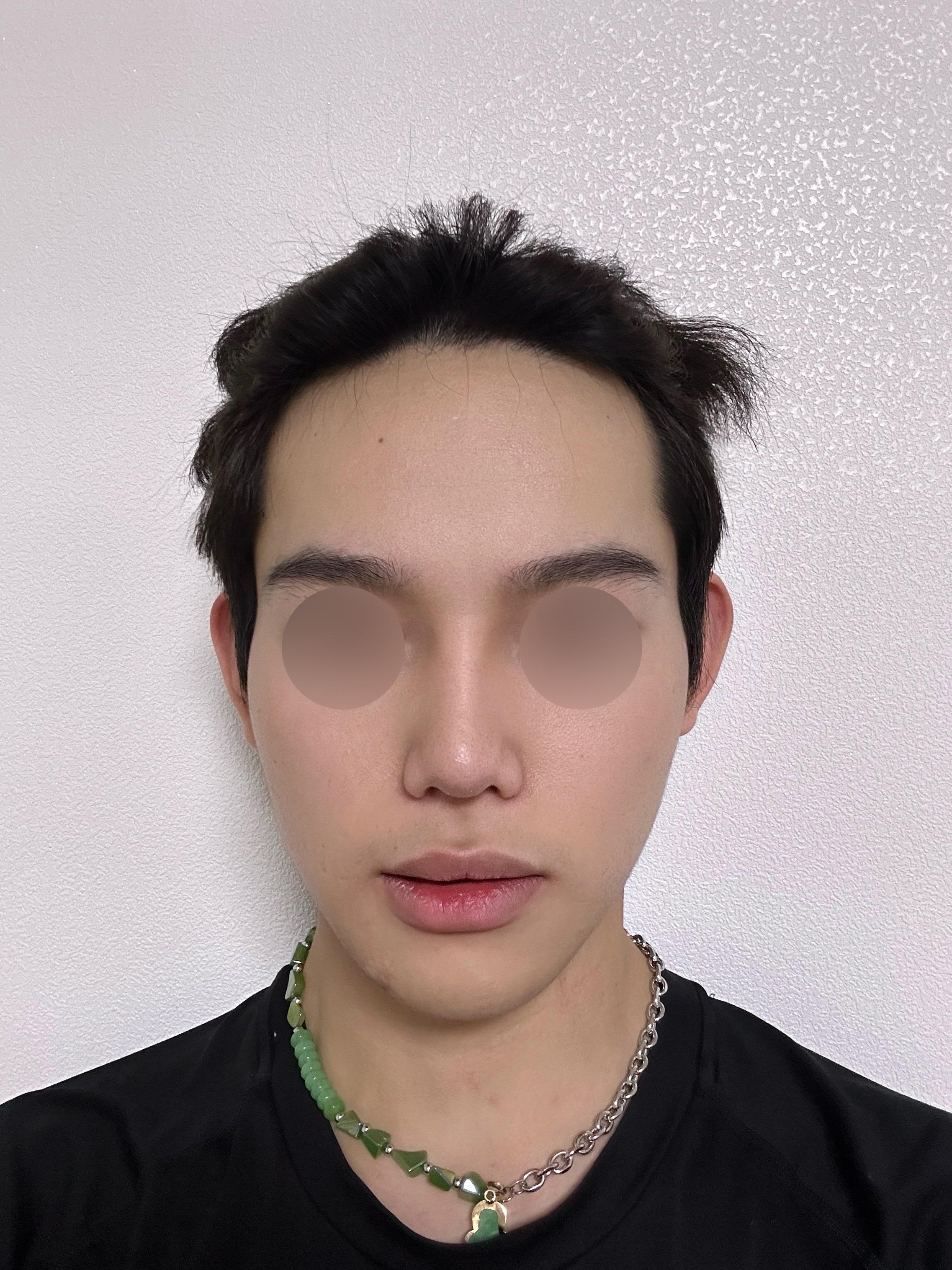 後