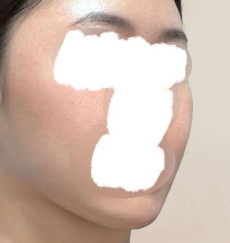 後
