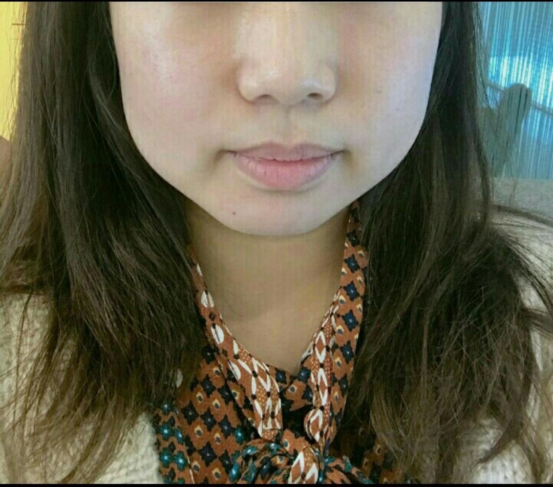 後